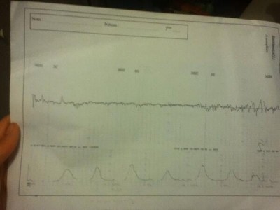 Le monitoring